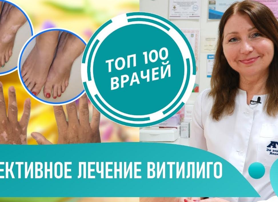 Лечение витилиго народными средствами в домашних условиях