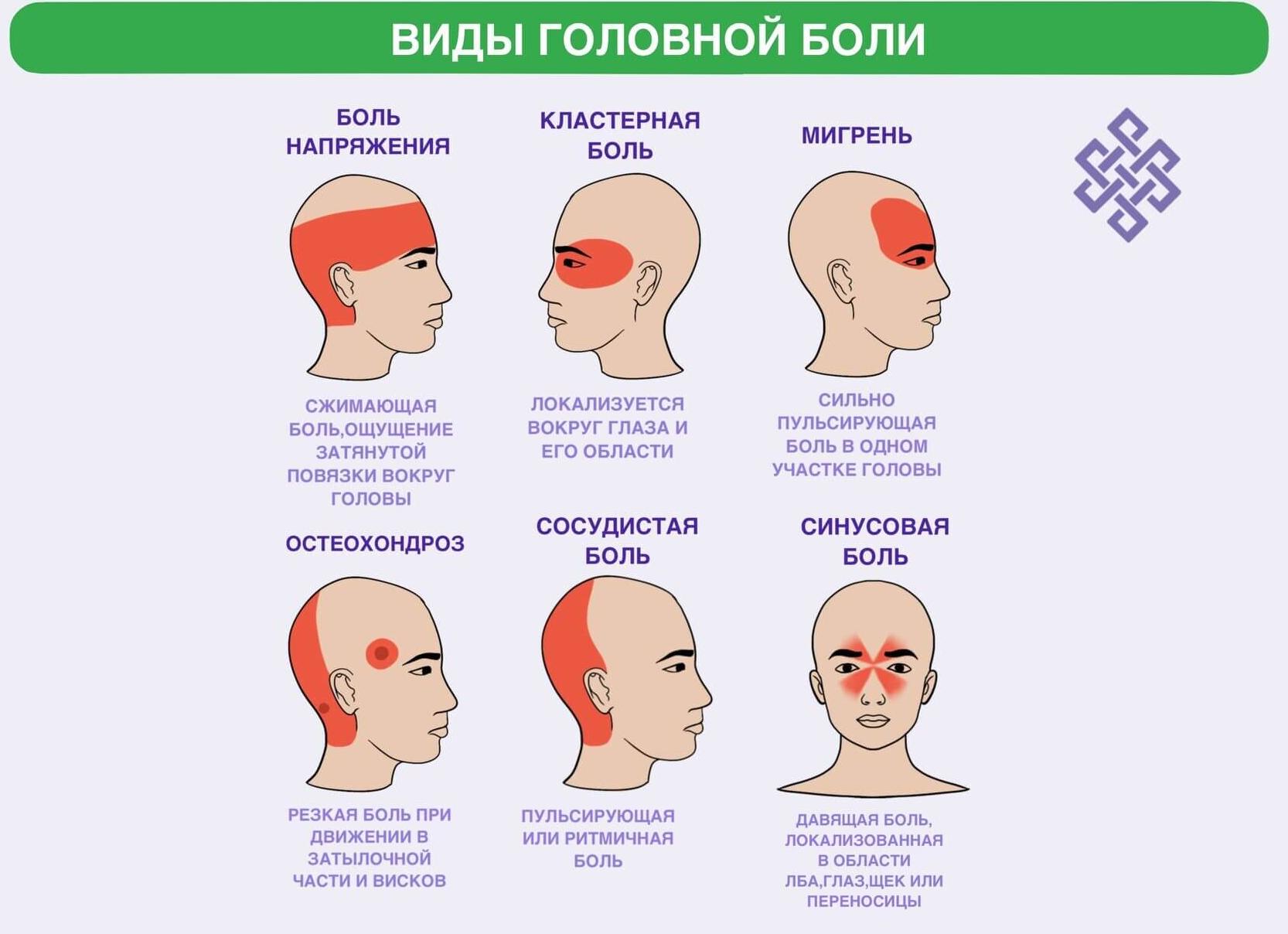 Как болит голова при мигрени