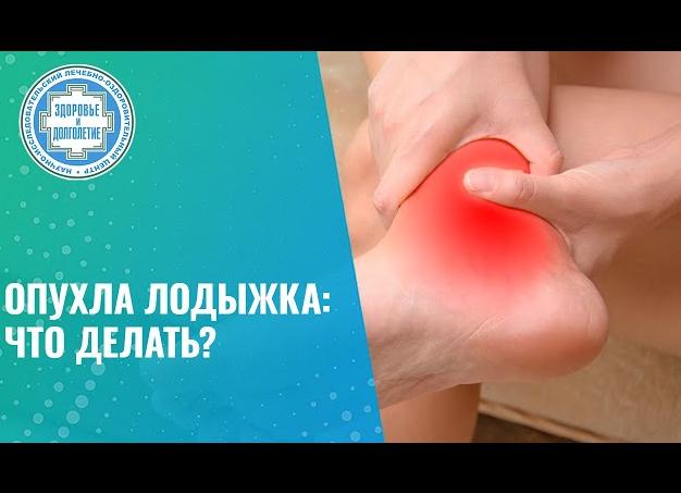 Что делать, если опухла и болит нога?