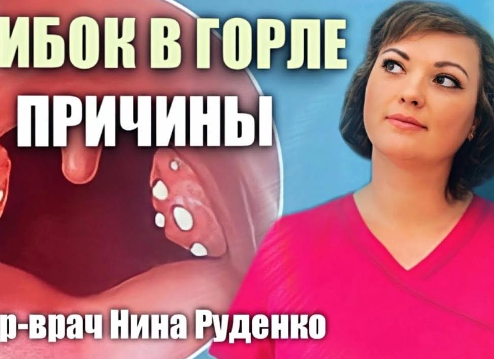 Грибок в горле у ребенка и взрослого — причины возникновения, симптомы, диагностика и лечение