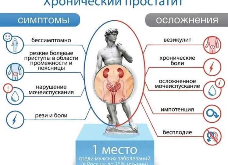 Хронический простатит — симптомы, причины и признаки заболевания