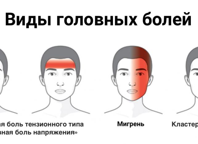 Все про кластерные головные боли