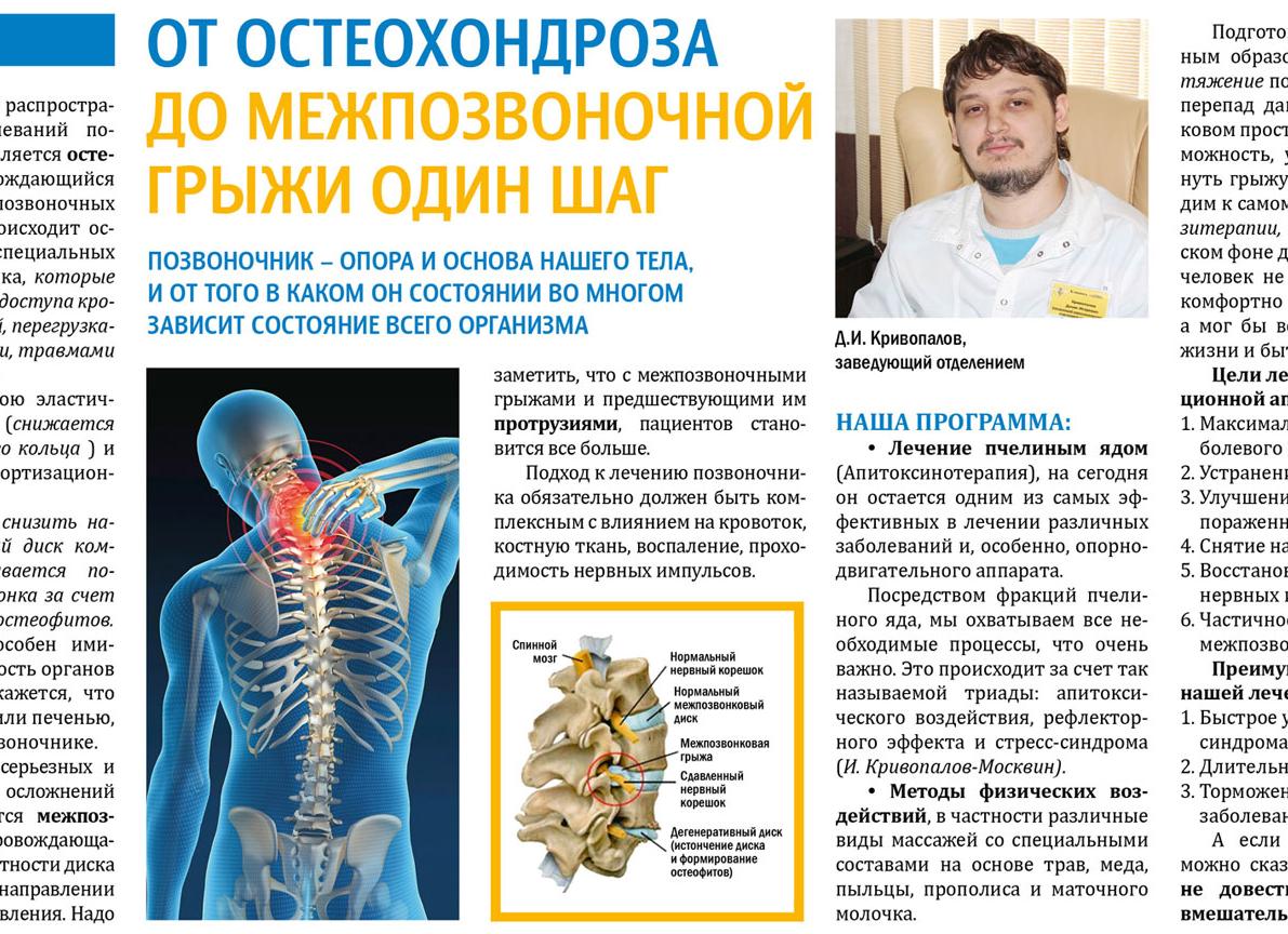 Узнаем все симптомы грудного остеохондроза у женщин