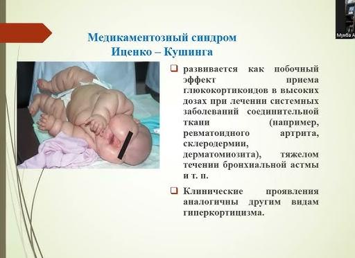 Лечение артрита у детей — медикаментозные и народные средства, физиотерапия и упражнения