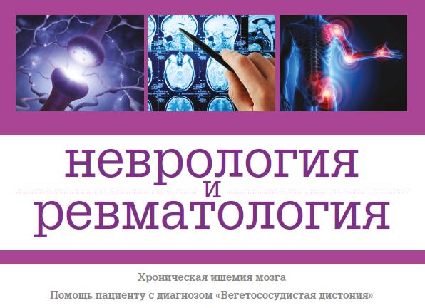 Самое важное про нейропатию срединного нерва