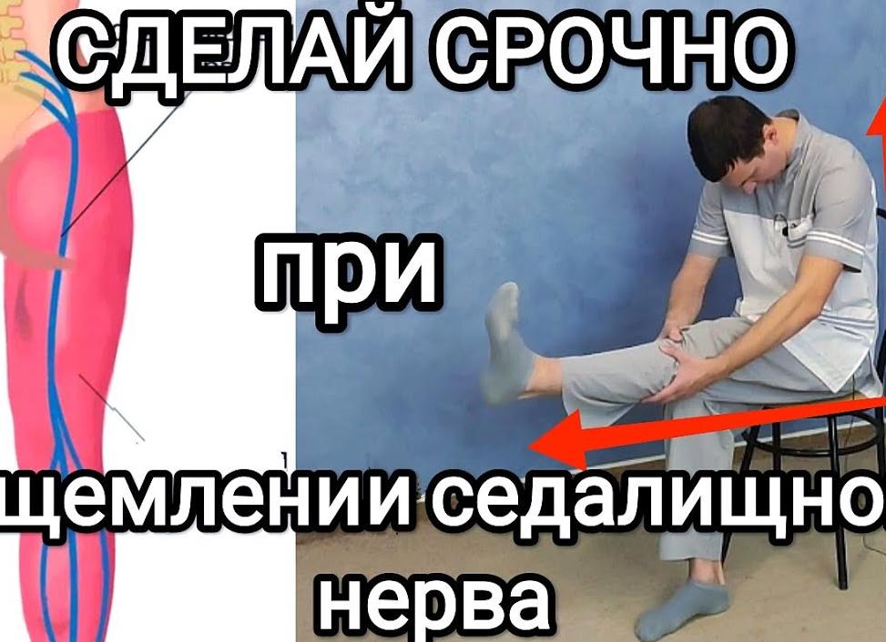 Защемление седалищного нерва: как выявить, диагностировать и лечить