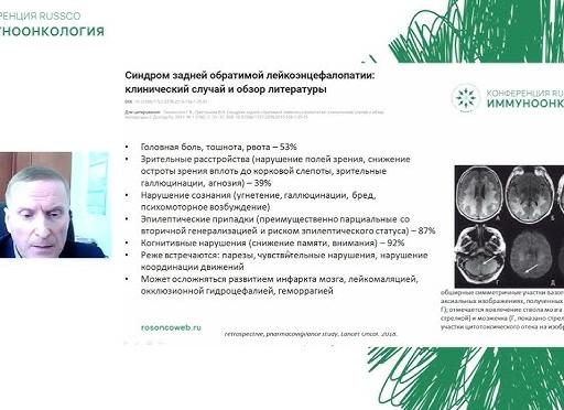 Агнозия: причины, симптомы и лечение нарушенного восприятия действительности