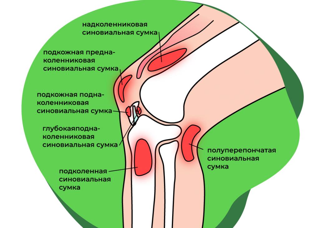 Болит нога в области колена