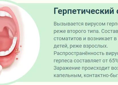 Признаки стоматита у детей и взрослых