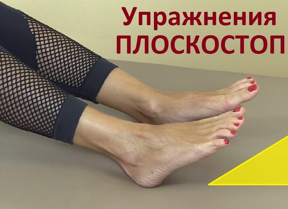 Профилактика плоскостопия у взрослых — упражнения и выбор обуви