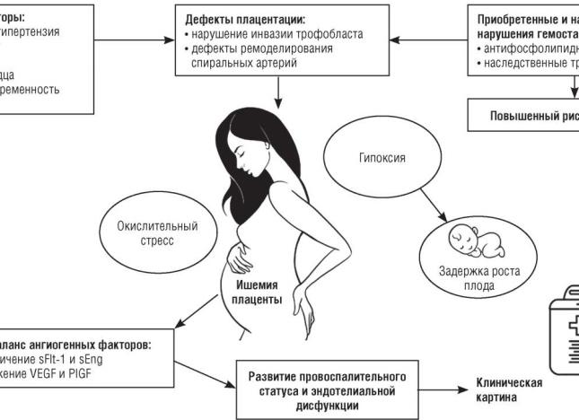 Причины, симптомы и лечение вазоспазма сосудов головного мозга