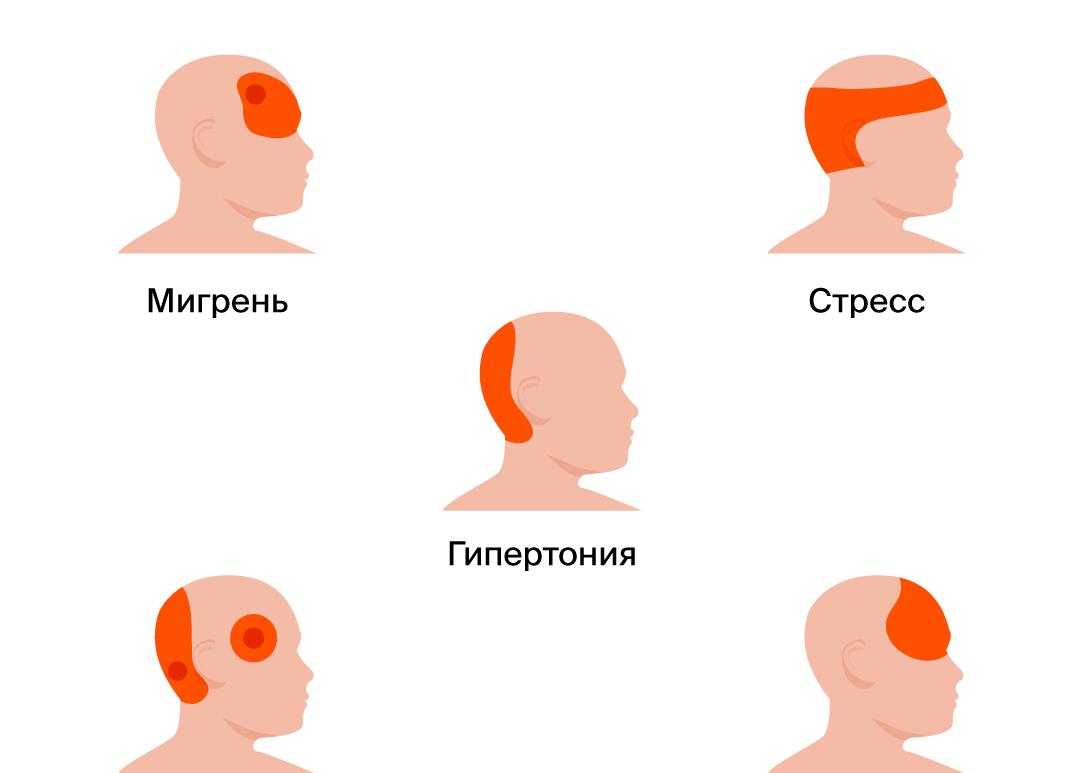 Узнаем, почему возникает боль в голове после курения