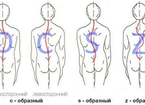 Как делать лечебный массаж при сколиозе — специальная техника и видео