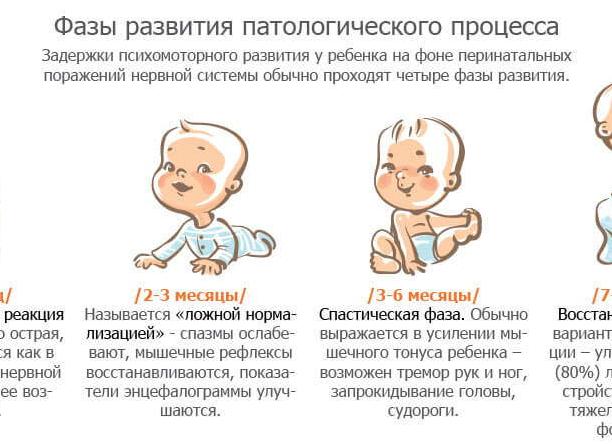 Перинатальное поражение центральной нервной системы: симптомы и лечение ППЦНС
