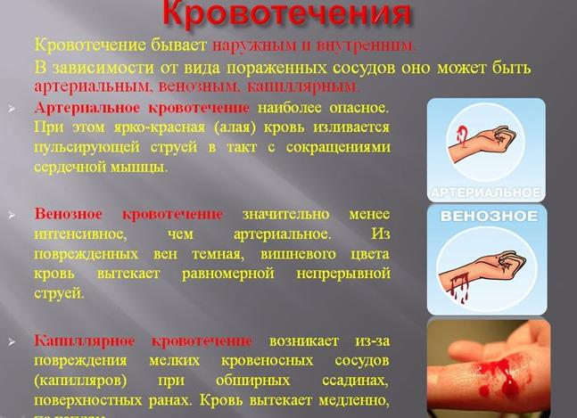Остановка артериального кровотечения — признаки и первая помощь