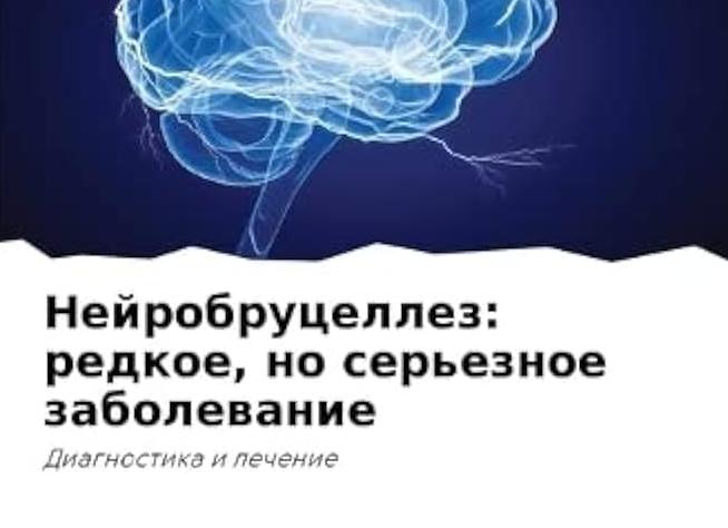 Энцефалопатия головного мозга — причины заболевания и классификация, симптомы, диагностика и лечение