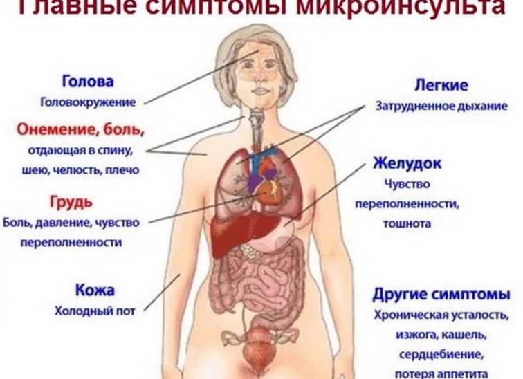 Симптомы микроинсульта у женщин — причины и первые признаки, первая помощь, способы терапии и последствия