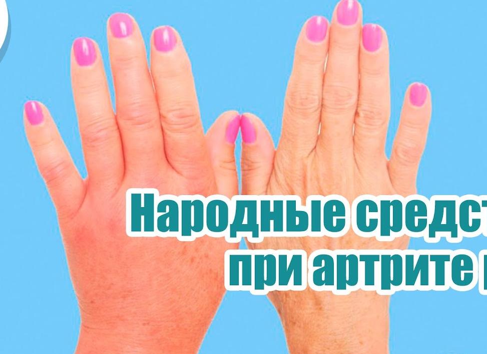 Народные средства от артрита пальцев рук — рецепты для лечения в домашних условиях