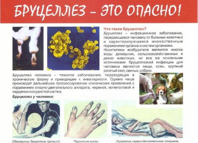 Опасность бруцеллеза для человека: как распознать симптомы и начать лечение