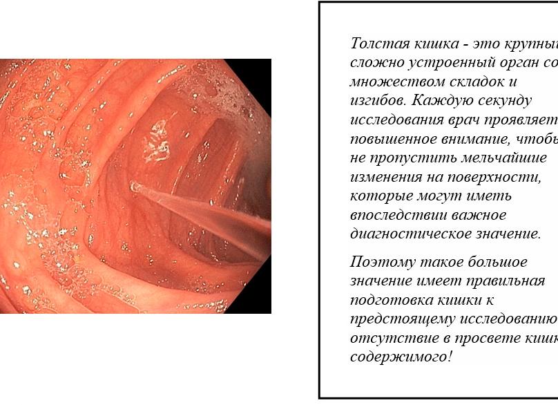 Золотистый стафилококк в кале: особенности появления у детей и взрослых