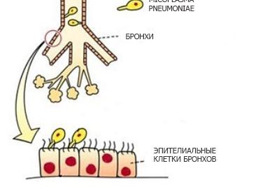 Микоплазма пневмония у детей и взрослых — причины возникновения, симптомы, диагностика и лечение