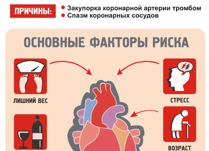 Инфаркт миокарда — что это такое и каковы его причины и последствия?