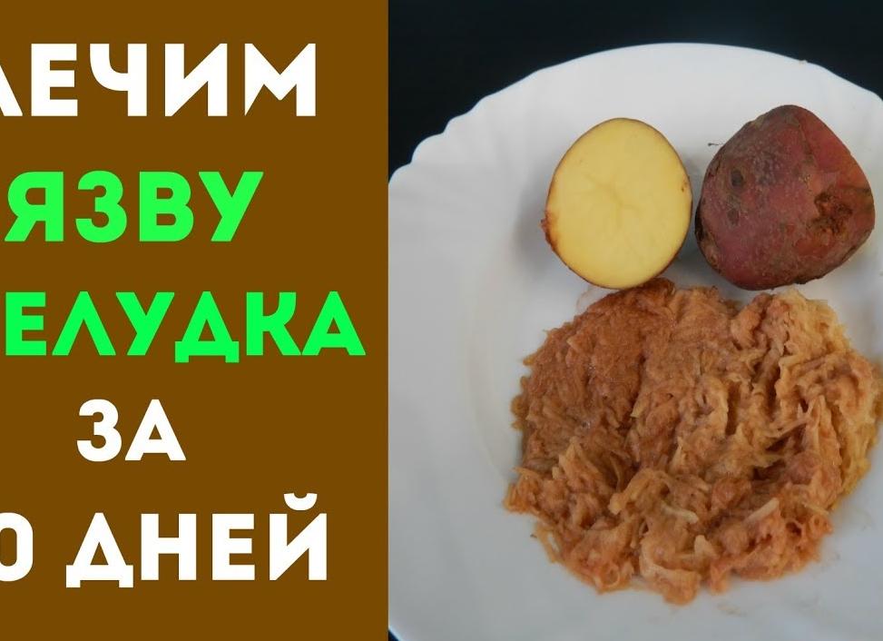 Народные средства от язвы желудка для эффективного лечения