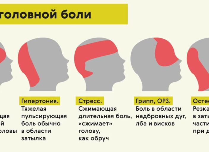 Все про головные боли в области затылка