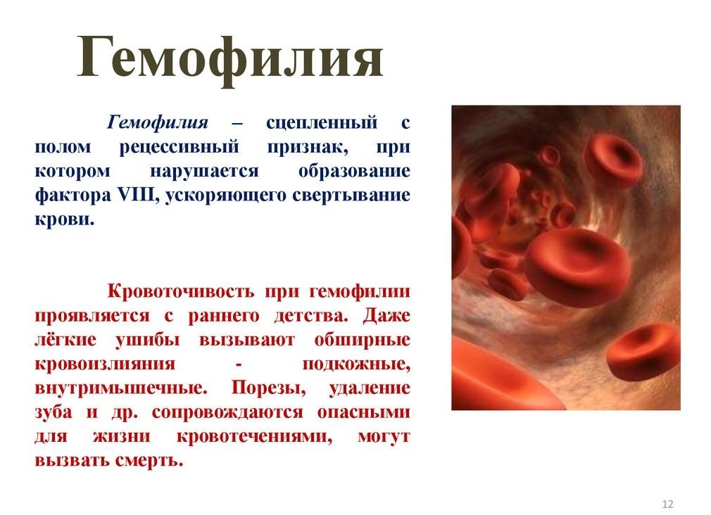 Что такое гемофилия — определение, признаки и причины заболевания, диагностика и способы лечения