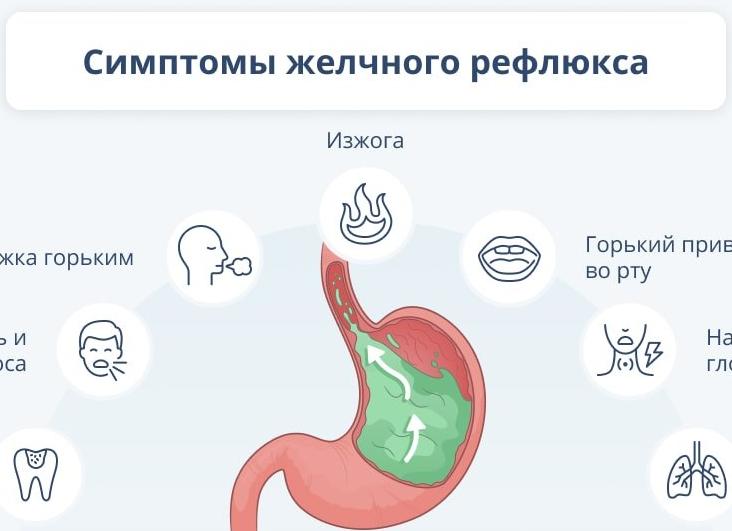 Лечение заброса желчи в желудок: фармакологические и хирургические методики