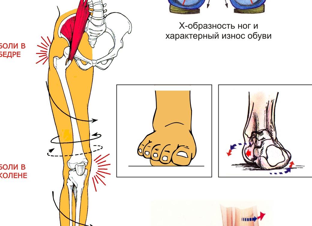 Почему болят суставы ног и что делать в этом случае?