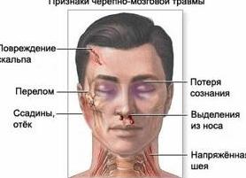 Последствия перелома основания черепа — клинические симптомы и лечение травмы