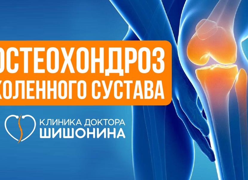 Все про лечение остеохондроза коленного сустава