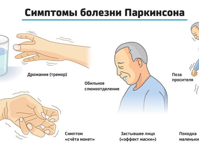Причины и начальные признаки болезни Паркинсона — симптомы и лечение заболевания
