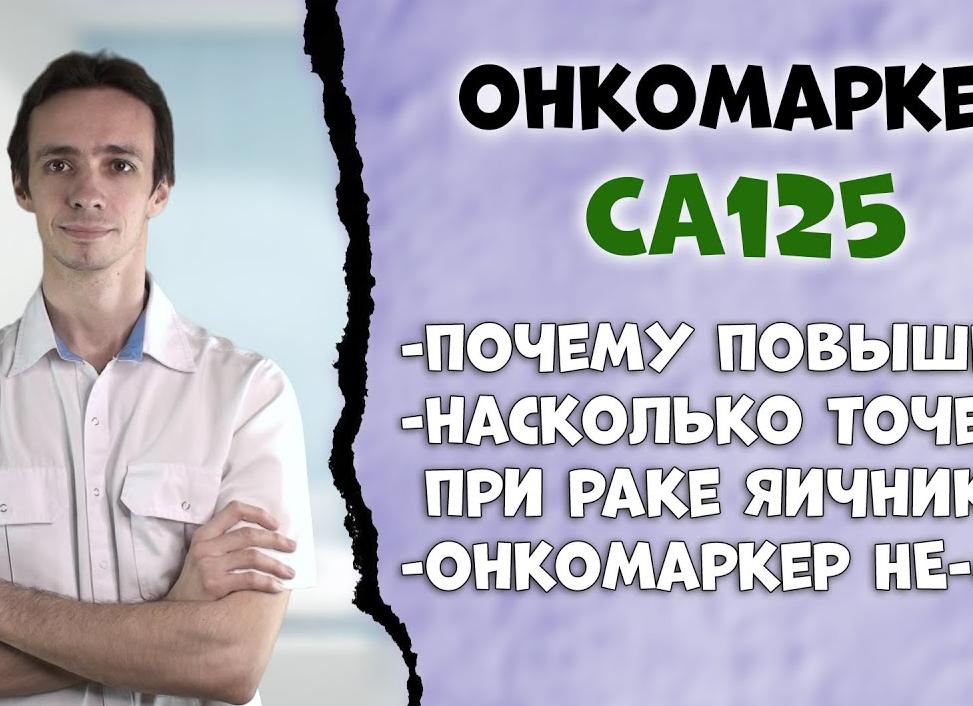 Анализ крови СА-125 при кисте яичника
