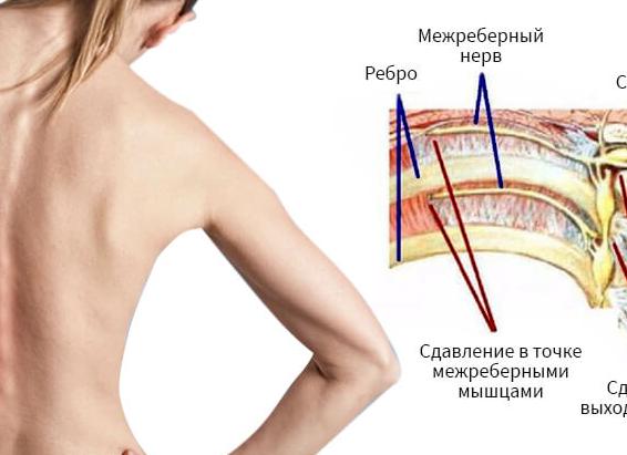 Разберемся в симптомах и лечении невралгии затылочного нерва