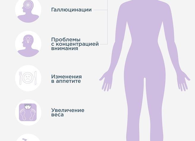 Катаплексия: современный взгляд на проблему