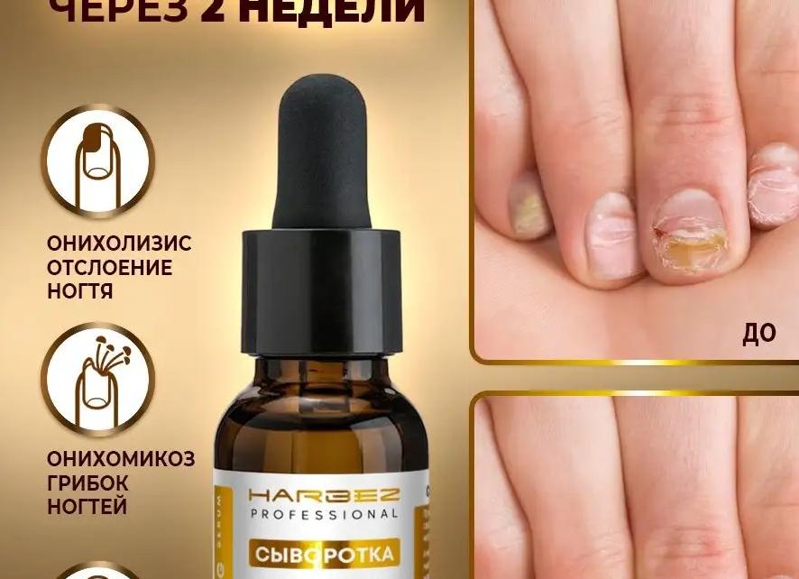 Средство от грибка ногтей на руках