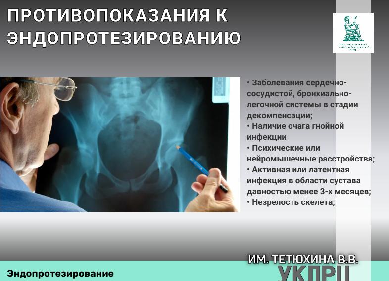 Противопоказания для лапароскопии — абсолютные и относительные