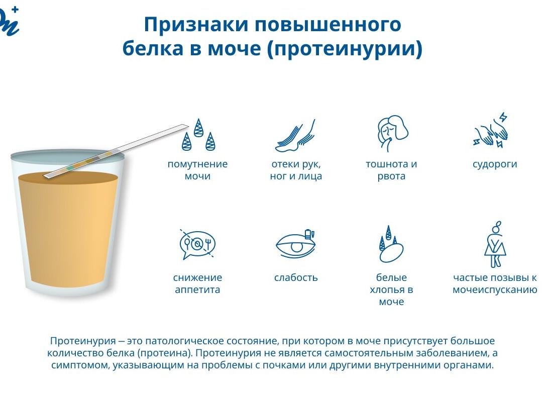 Повышенный белок в моче: причины и лечение