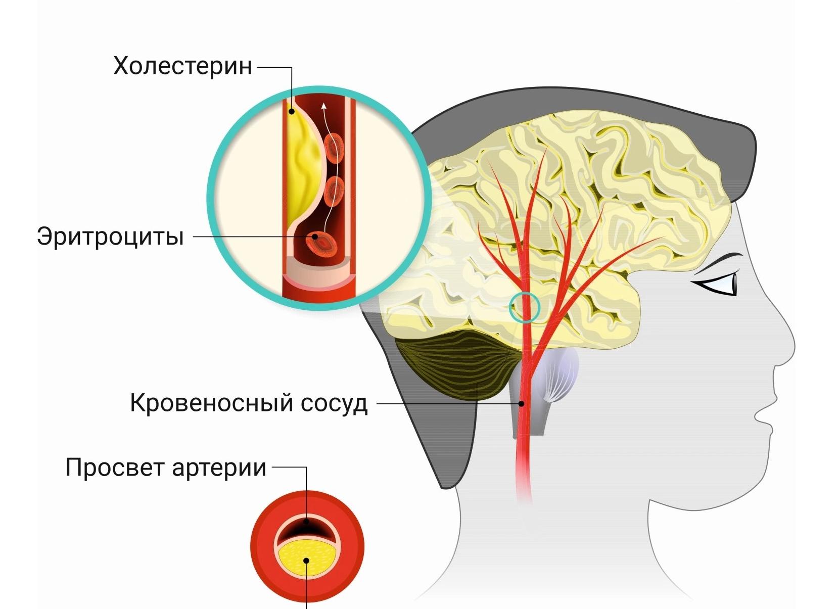Эхоэнцефалоскопия головного мозга: суть процедуры и расшифровка результатов