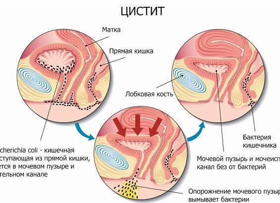 Кишечная лямблия: особенности и механизмы развития паразитарной инфекции