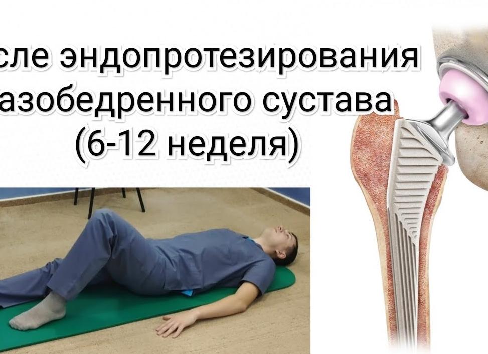 Лечебная гимнастика — необходимый комплекс упражнений после инсульта