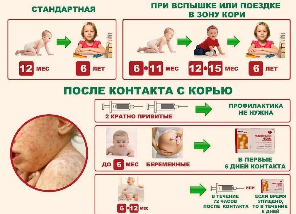 Прививка корь, краснуха, паротит: как проводят вакцинацию