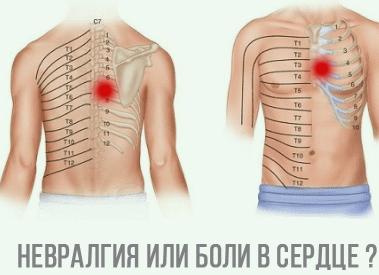 Узнаем причины боли в грудине при нажатии