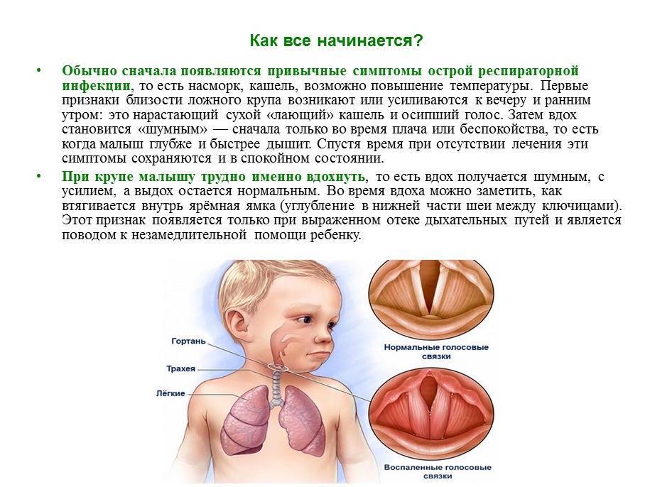 Что делать и как лечить лающий кашель у ребенка?