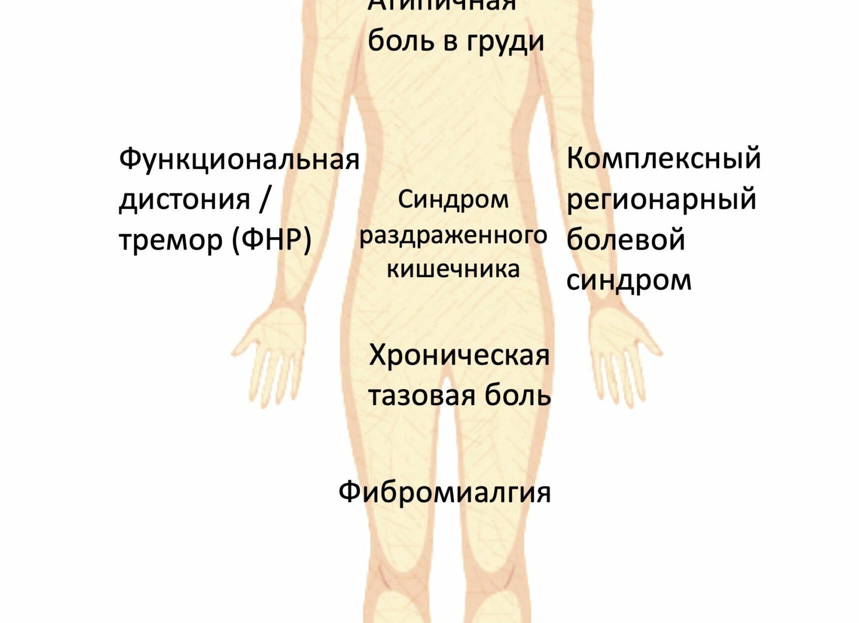 Фибромиалгия существует — причины, симптомы и лечение хронического стресса и усталости