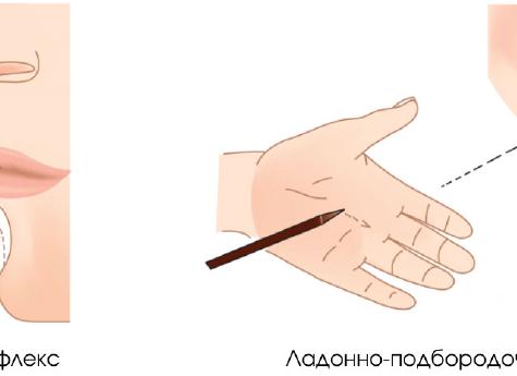 Ладонно подбородочный рефлекс Маринеску Радовичи