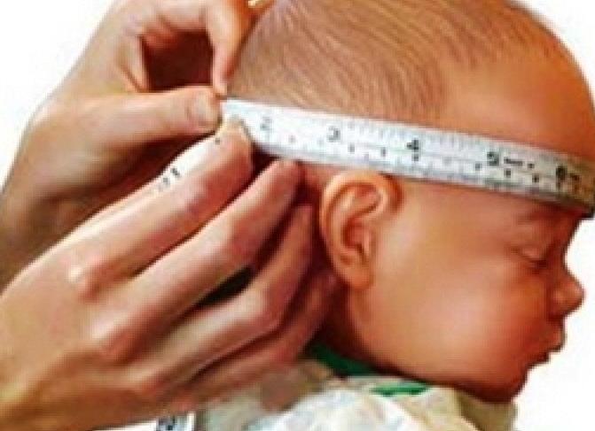 Вентрикуломегалия — увеличение желудочков головного мозга у плода