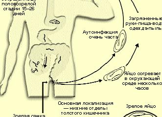 Токсокароз у детей — симптомы и методы лечения заболевания